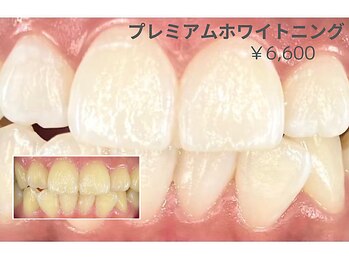 リモア(REMORE)/初めての方でも不安なし！