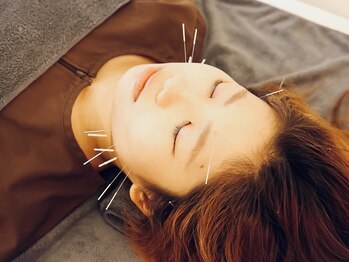 ユジュアンド(YUJ&)/電気を流さない美容鍼