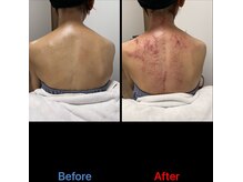 シュガーリングハウスレディ(SugaringHouse LADY)/なんとなくの不調改善にも！