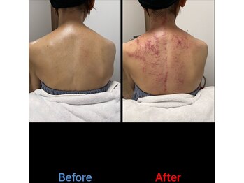 シュガーリングハウスレディ(SugaringHouse LADY)/なんとなくの不調改善にも！