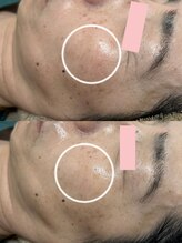 ビビィ(Bibiy)/クリスティーナ/アンストレス