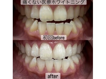 ヤット 森ノ宮(yatto.)/20代女性