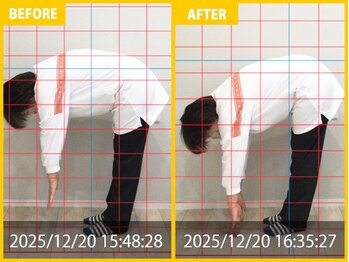 整体院 元 宇城松橋店/腰の痛み、硬さの悩み