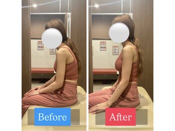 ナオル整体 宮崎院(NAORU整体)/20代女性施術事例【姿勢改善】