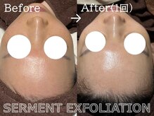 ココモンド(COCOMONDO)/セルマン艶肌ピーリング