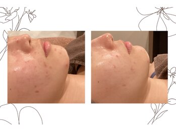 レゴリス 横浜店(REGOLITH)/