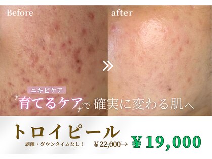 ウノ アッベリーナ(UNO × abbel'lina)の写真