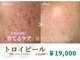 ウノ アッベリーナ(UNO × abbel'lina)の写真