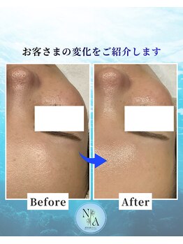 夏秋美肌サロン/Before-After