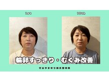 守谷やまゆり鍼灸整骨院/