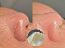 ルーナジェーナ(Luna llena)/池袋　エステ　ルーナジェーナ