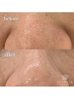 ケイリー(kaylee)/ハーブトリートメント