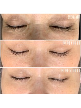 キビック(KIBIK)/【プラズマシャワーで美肌ケア】