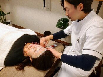 かんの鍼灸整骨院の写真/気になる目元、口元のほうれい線をどうにか改善したい!一度お越しください。施術後の変化に定評あり◎