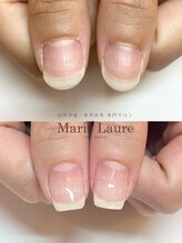 マリーロール 梅田店(Marie Laure)/深爪矯正/自爪育成/自爪風