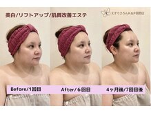 えすてさろん ケイアンドエフ(k&f)の雰囲気（「鏡を見るのが楽しく♪」K&Fフェイシャルで小顔,美白,肌質改善）
