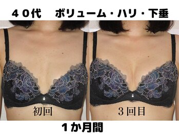 バストサロン メルベイユ(Merveile)/バスト位置UP、谷間UP
