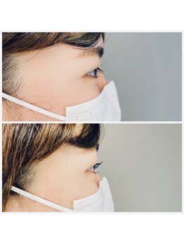 アドノス(Adonos)/