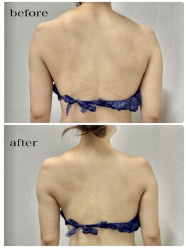 エンチャント(ENCHANT)/プレ花嫁さんも肩凝りさんも☆