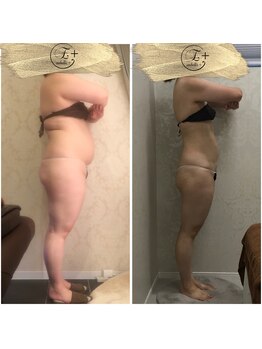 アンベリールプラス(embellir+)/100キロから70キロ減量成功