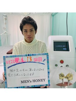 ハニーアイズ(Honey Eyes)/最新の脱毛マシンルミクスA9X