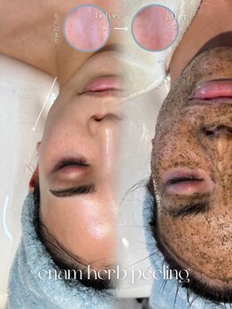 エナム(enam.)/最新ハーブピーリング導入!