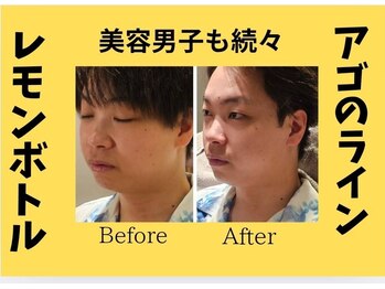 アン 銀座(ann)/輪郭が気になる美容系男子