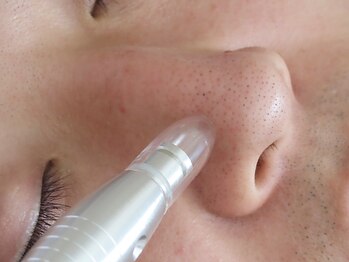 ヴェアリー 広尾(VARY)の写真/毛穴の皮脂・開き・黒ずみ…男の肌悩み、今こそ本気でケアしよう!清潔感のあるツルすべ肌で第一印象アップ