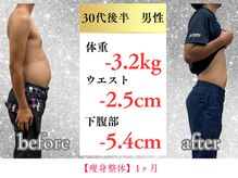 ボディメイク アールエフ サクラ接骨院(bodymake RF SAKURA接骨院)/30代　1ヶ月で下腹部ー5.4cm
