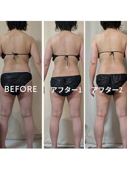 ひぺりかむ/\4Day卒業/3Dayスリムボディへ