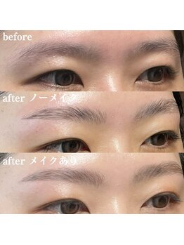 ブリリアント(brilliant)/ハリウッドブロウリフト