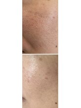 エスビーエス オキナワ(SBS OKINAWA)/