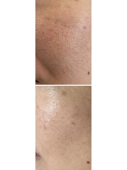 エスビーエス オキナワ(SBS OKINAWA)/