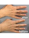 ハンドケアビフォーアフター