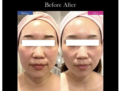 ティアレソワン(tiare soin)の写真