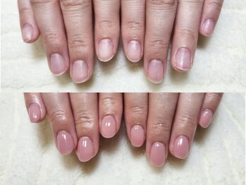 グラシナ なんば店/深爪/自爪育成/フィルイン