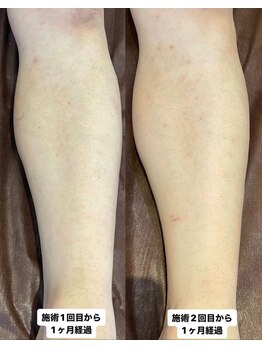 アレッド 大阪店(ared.)/案外みられている！？