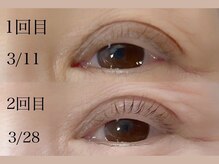 アイアンド(i&)/年齢に左右されないマイラミ