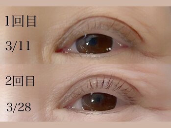 アイアンド(i&)/年齢に左右されないマイラミ