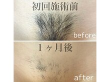 プライベートサロン ビビ(BiBi)の雰囲気（Vラインの形残しやハイジニーナ、ご相談ください◎）