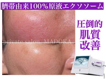 マドカ(MADOKA)の写真