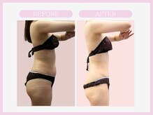 スリムライン 盛岡店(The Slim Line)/before→after