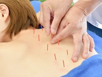 杜の鍼灸院の写真/《鍼灸通の方も納得!》本気の施術を口コミ投稿で2回目まで特別割引でご提供いたします。