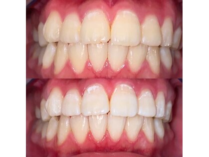 セルフホワイトニングサロン origin 大分王子店の写真