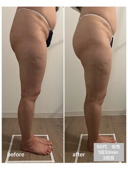 エムプラス(Mplus.)/ビジリス3回目!