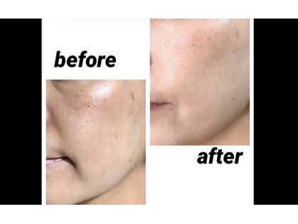 ハナナ(Hanana)の写真