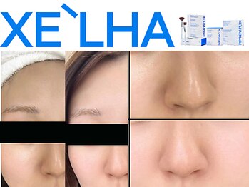 レアリゼ(La Realiser)の写真/毛穴の黒ずみ、ざらつきに働きかけるピーリング！セラピールでお肌を整えよう◎