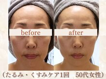 スリーエッセンス(3THREE ESSENCE)