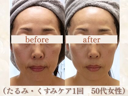スリーエッセンス(3THREE ESSENCE)の写真