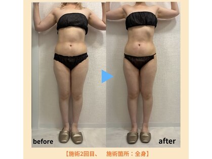 エラ(Ella)の写真